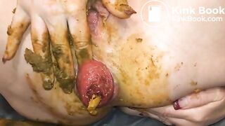 Shitty prolapse - video 4
