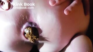 Hardcore and Painful Constipation.