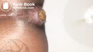 Black girl pooping