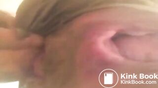 Asian panty scat prolapse fisting