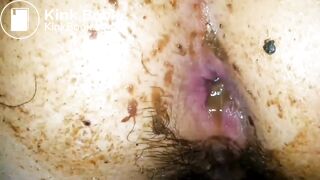 Korean scat anal sex - video 2