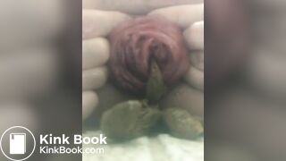 prolapse and shit7