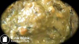 Outdoor poop diarrhea video 5