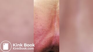 Gassy diarrhea - video 3