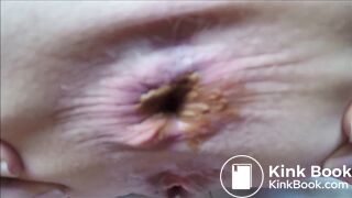 extremly close pooping footage - video 5