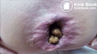extremly close pooping footage - video 5