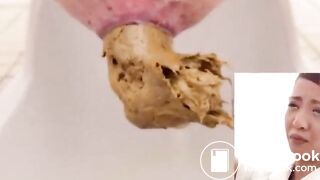 Unusual combination of hard and soft poop