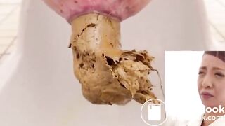 Unusual combination of hard and soft poop