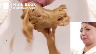 Unusual combination of hard and soft poop