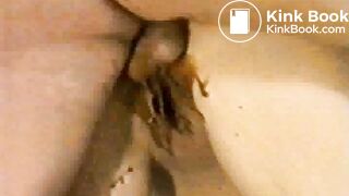 Diarrhea Wet and shitty anal