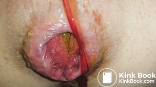 SHARTS & FARTS VOL.3