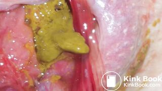 SHARTS & FARTS VOL.3