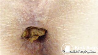 very close pooping footage. - video 7