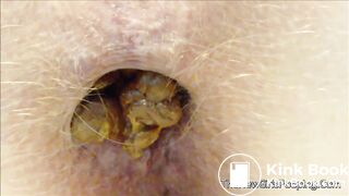 very close pooping footage. - video 7