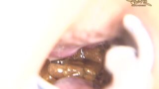 See inside butthole By Speculum