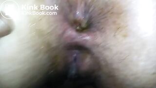 Cú aberto e cagado depois do anal