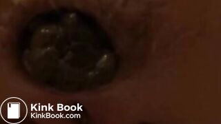 very close pooping footage