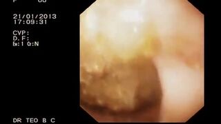 Look inside woman’s ass