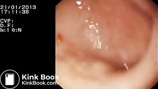 Look inside woman’s ass