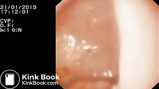 Look inside woman’s ass