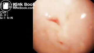 Look inside woman’s ass