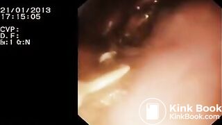 Look inside woman’s ass