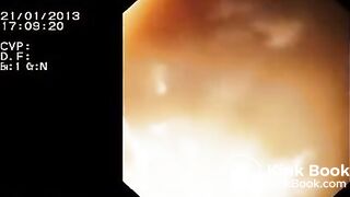 Look inside woman’s ass