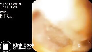 Look inside woman’s ass