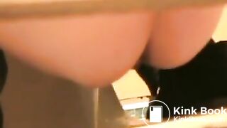 Japanese toilet prolapse