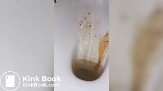 diarrhea again! a little shart..