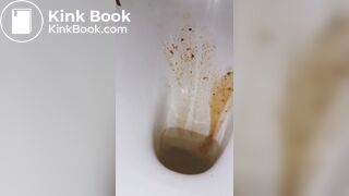 diarrhea again! a little shart..