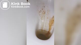 diarrhea again! a little shart..