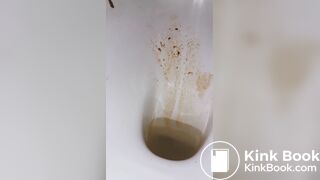 diarrhea again! a little shart..