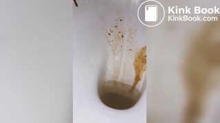 diarrhea again! a little shart..