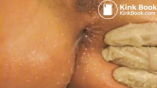 German MILF's enema expulsion and gyno examination