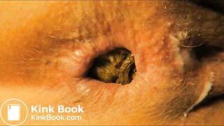 Close-up Shitting Assholes