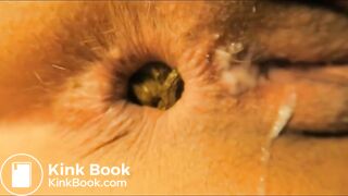 Close-up Shitting Assholes