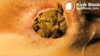 Close-up Shitting Assholes