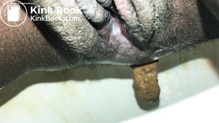 Turd knocking @ my back door