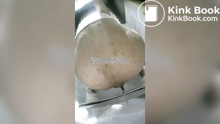 The girl used her hands to remove feces from her anus.