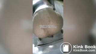 The girl used her hands to remove feces from her anus.