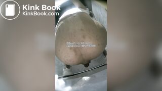 The girl used her hands to remove feces from her anus.