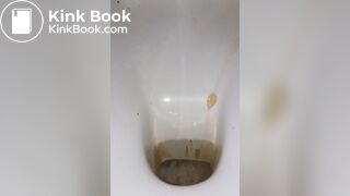 diarrhea with big spray