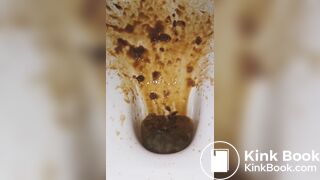 diarrhea with big spray