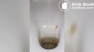 diarrhea with big spray