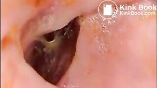 Camera in Arse with poo Asian. Buttcam