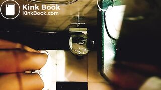 Teen girl has explosive diarrhea farting