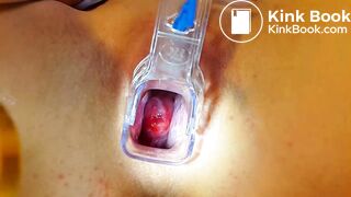 AC Stuffing Her Cunt With Shit