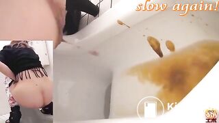 18 years old girls having diarheea