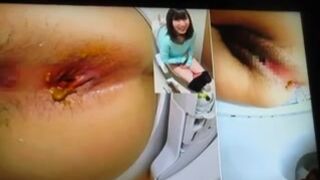 japanese girl shit 4